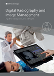 /media/downloads/Product overview Digital X-ray Human medicine_human_EN.pdf.png